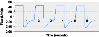 <strong>The RT assesses the flow-time scalar from an apneic patient mechanically ventilated in the VC-CMV mode.The most appropriate action for this patient is to do which of the following? </strong> A) Decrease the set flow rate. B) Reduce the set ventilator rate. C) Increase the inspiratory time. D) Decrease the set tidal volume.