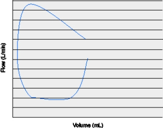 <strong>The flow-volume loop below is representative of which of the following conditions? </strong> A) System leak B) Intrinsic PEEP C) Inadequate flow D) Active exhalation