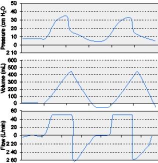 <strong>The graphic below for a patient receiving mechanical ventilation shows which of the following conditions? </strong> A) Leak in the circuit B) Active inspiration C) Active exhalation D) Intrinsic PEEP