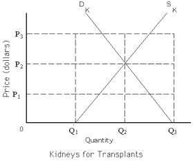 <strong>Exhibit 4-5 Refer to Exhibit 4-5.Suppose the government imposes a price ceiling at P = $0.The result will be a</strong> A) shortage of kidneys equal to (Q3 - Q1). B) surplus of kidneys equal to (Q3 - Q1). C) shortage of kidneys equal to (Q2 - Q1). D) surplus of kidneys equal to (Q2 - Q1).