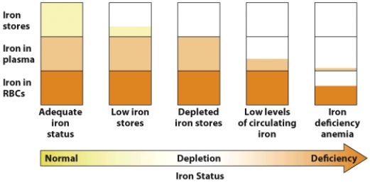 Based on this visual, discuss how anemia is the last stage of iron deficiency.  <div style=padding-top: 35px> 
