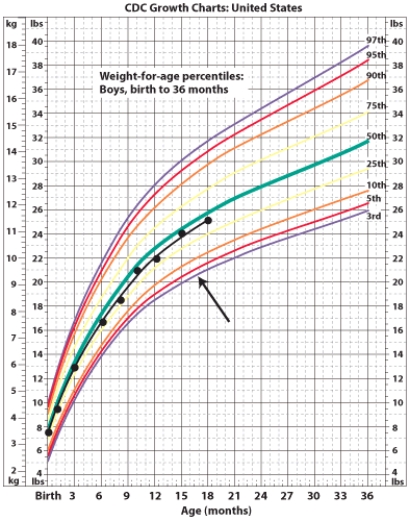 <strong>An infant boy's growth follows the purple line indicated with the arrow. Based on this growth chart, he is experiencing </strong> A) diabetes. B) failure to thrive. C) obesity. D) overweight.