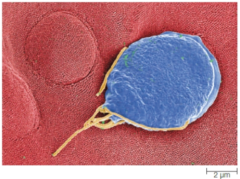 <strong>Figure 21.5 Four of the following are true of euglenoids. Which statement is false?</strong> A) Many move by pseudopods. B) Many contain chloroplasts. C) Many absorb nutrients from their environment in a heterotrophic manner. D) Their cell body is surrounded by a pellicle. E) They use a contractile vacuole to maintain water balance.