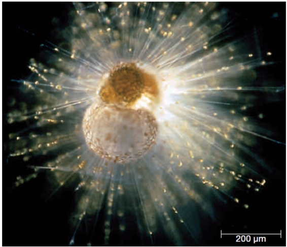 <strong>Figure 21.9 What is NOT a characteristic of radiolarians?</strong> A) They have perforated shells of calcium carbonate. B) They form part of the plankton. C) They use pseudopods for feeding. D) They have vacuoles that impart buoyancy. E) They are heterotrophic protists.