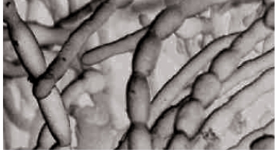 <strong>Figure 23.3   Which statement best describes the value of fungi in the environment?</strong> A) ​Fungi fix nitrogen from the air for use by plants. B) ​Fungi trap sunlight energy in the form of carbohydrates. C) ​Fungi release elements from organic matter. D) ​Fungi enrich the soil by decreasing the rate of decay of organic matter. E) ​Fungi remove toxic metals from the soil. <div style=padding-top: 35px> 