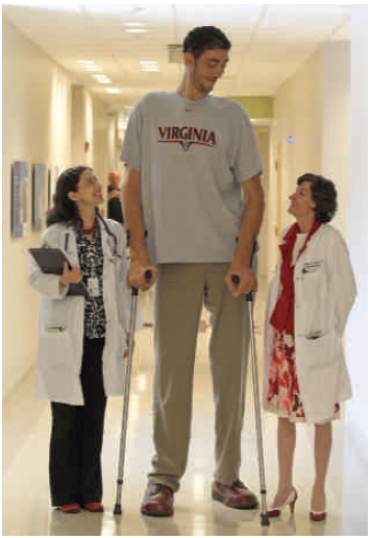 Figure 34.6 -What is the most likely cause of the excessive growth exhibited by the person in the center of the accompanying figure?