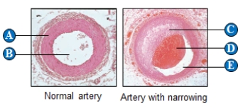 Use the figure above to answer the following question. -The anatomical structure identified with the letters B and E in the figure above is the ____.