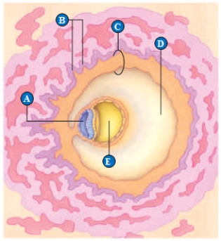 Use the figure above showing human embryonic developmental day 14 to answer the following question. -Which of the following structures represents the yolk sac?