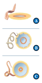 <strong> In the accompanying figure,a(n)____ has body plan B,which features a __________. </strong> A) roundworm; pseudocoelom B) roundworm; coelom C) tapeworm; no body cavity D) annelid; coelom E) earthworm; pseudocoelom