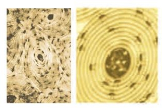 <strong>Figure 31.6F What kind of tissue is shown in the accompanying images? </strong> A) Blood B) Adipose C) Bone D) Cartilage E) Dense connective