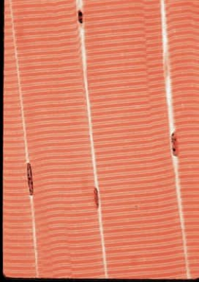 <strong>Figure 31.8A The accompanying figure is a micrograph of what kind of tissue? </strong> A) Cardiac muscle B) Skeletal muscle C) Smooth muscle D) Cartilage E) Dense connective