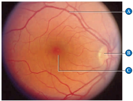 <strong>Figure 33.21C The letter C in the above figure represents the ____. </strong> A) cortex B) cornea C) fovea D) blood vessels E) optic nerve