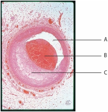 Figure 36.18 -The structure identified with the letters B in the figure above is a(n)____.
