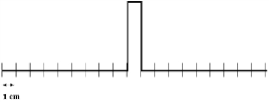 <strong>Two pulses are traveling towards each other at 10 cm/s on a long string at t = 0 s,as shown below. Which diagram below correctly shows the shape of the string at 0.5 s?</strong> A) B) C) D) E)