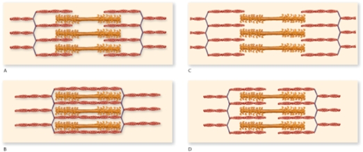 <strong>According to the figure,which one represents the muscle in an optimal condition for contraction? </strong> A)A B)B C)C D)D