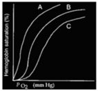 <strong>Curve B below represents the oxygen-hemoglobin dissociation curve for normal body temperature,arterial hydrogen ion concentration,and DPG concentration. \mathrm { P } _ { \mathrm { o } _ { 2 } } (mm Hg) </strong> A)Curve A may represent the dissociation at higher than normal arterial hydrogen ion concentration B)Curve C may represent the dissociation at lower than normal body temperature C)Curve A may represent the dissociation at very low DPG levels D)Both curve A may represent the dissociation at higher than normal arterial hydrogen ion concentration and curve C may represent the dissociation at lower than normal body temperature are correct E)Both curve A may represent the dissociation at higher than normal arterial hydrogen ion concentration and curve A may represent the dissociation at very low DPG levels are correct