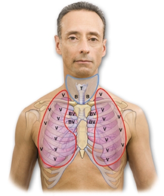 The nurse is auscultating the client's lungs and is able to auscultate bronchovesicular sounds over the client's right lung.Identify the area where the nurse is able to auscultate these sounds by drawing an arrow to this area.