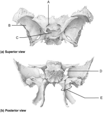 <strong> Figure 7.2 Using Figure 7.2, match the following:</strong> A) B B) E C) D D) A E) C Encloses pituitary gland.