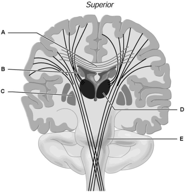 <strong> Figure 12.2 Using Figure 12.2, match the following:</strong> A) A B) B C) C D) D E) E Globus pallidus.