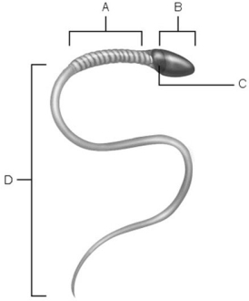 <strong> Figure 27.2 Using Figure 27.2, match the following:</strong> A) C B) B C) A D) D Area of compacted DNA.