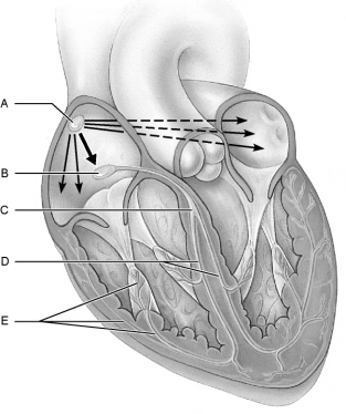   Figure 18.1Using Figure 18.1, match the following: -SA node.
