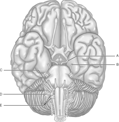 Figure 13.1Using Figure 13.1, match the following: Receptor.