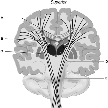 Figure 12.2Using Figure 12.2, match the following: The is a conduction pathway between higher and lower brain centers and houses nuclei for cranial nerves V- VII.