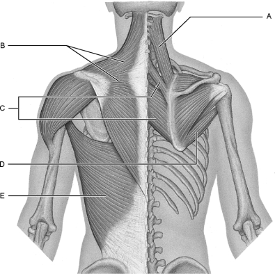 Figure 10.3Using Figure 10.3, match the following: Levator scapulae.