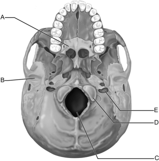 <strong> Figure 7.3 Use the diagram above to answer the following questions. Which letter indicates the palatine bone that forms part of the hard palate?</strong> A) A B) B C) C D) D E) E