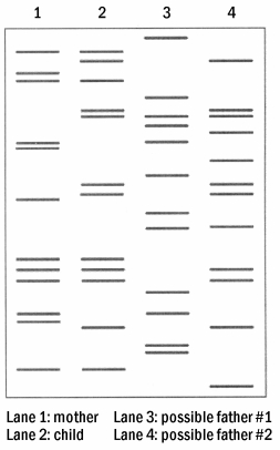 <strong>A husband and wife are in the process of getting a divorce. During child- support hearings, the husband states that he should not pay child support as he feels that the child was actually fathered by one of the woman's various lovers. DNA restriction analysis was performed, with the results illustrated in the diagram below. The DNA of the husband in this case can be found in lane 3, whereas that of the suspected father is in lane 4. Based on this information,</strong> A)either man could be the father, and more tests are needed to discern paternity. B)neither man in question is the child's biological father. C)the husband is definitely the child's father. D)the husband is definitely not the child's father.