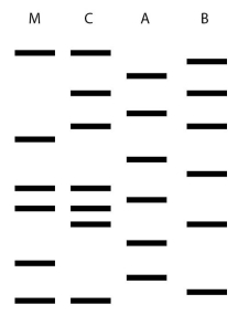 <strong>  Two men may be the father of a child.Figure 8.2 shows the results of a DNA fingerprint analysis to determine paternity.M is the mother,C is the child,A and B are the two men.What is the best interpretation of these results?</strong> A) The man identified as A is probably the father. B) The man identified as B is probably the father. C) Neither man is this child's father. D) Either man could be this child's father. E) Paternity cannot be determined from this data. <div style=padding-top: 35px> 