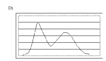 Select the requested distribution. Which of the distributions is multimodal and approximately symmetric?