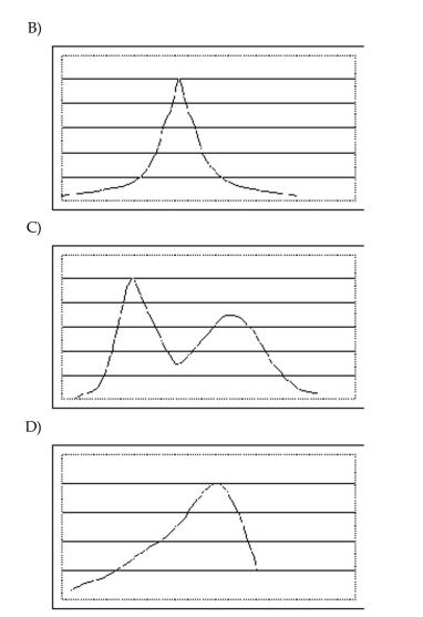 Select the requested distribution. Which of the distributions is skewed to the right?