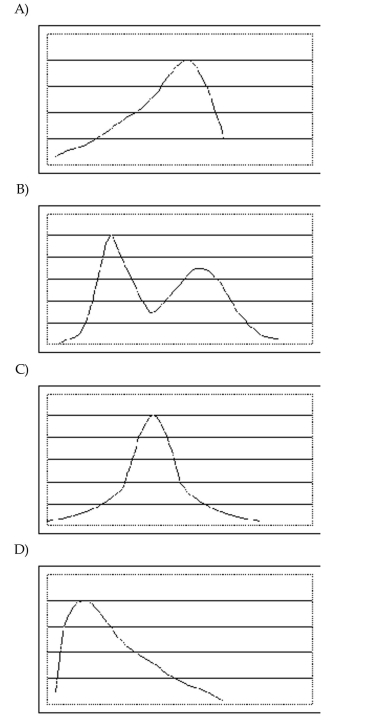 Select the requested distribution. Which of the distributions is symmetric?