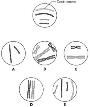 Use the figure to answer the question below. The unlettered circle at the top of the figure shows a diploid nucleus with four chromosomes that have not yet replicated. There are two pairs of homologous chromosomes, one long and the other short. One haploid set is black, and the other is gray. The circles labeled A to E show various combinations of these chromosomes.   What is the correct chromosomal condition at prometaphase of mitosis?