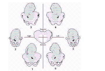 In the illustration below,which item depicts the LOT position?