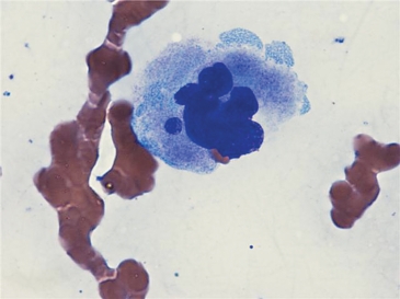 <strong> Identify the cell at the tip of the pointer (bone marrow smear).</strong> A) Myeloblast B) Megakaryocyte C) Nucleated red cell D) Reed Sternberg cell
