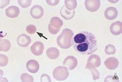 <strong> Name the cell at the tip of the pointer (Wright stain).</strong> A) Spherocyte B) Target cell C) Platelet D) Acanthocyte