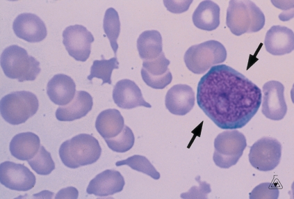<strong> Identify the cell at the end of the pointer.</strong> A) Lymphocyte B) Myeloblast C) Promyelocyte D) Monocyte