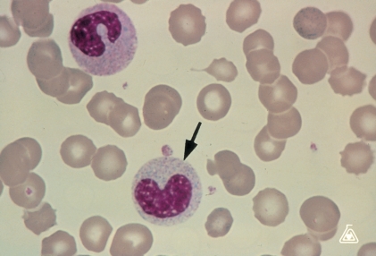 <strong> Identify the cell at the end of the pointer.</strong> A) Band neutrophil B) Metamyelocyte C) Promyelocyte D) Monocyte