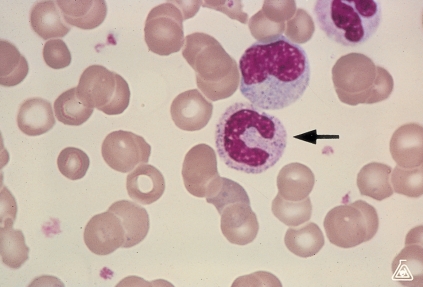 <strong> Identify the cell at the end of the pointer.</strong> A) Band neutrophil B) Metamyelocyte C) Promyelocyte D) Monocyte