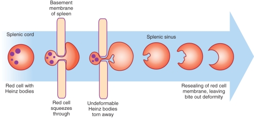 <strong> The cell pictured at the tip of the pointer is known as a (an):</strong> A) Sickle cell B) Acanthocyte C) Bite cell D) Stomatocyte