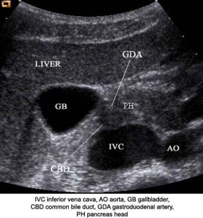 Using the image below, describe the anatomic relationship of the pancreatic head to adjacent structures.