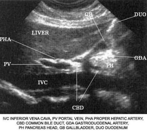 Using the image below, describe the anatomic relationship of the head of the pancreas to adjacent structures.