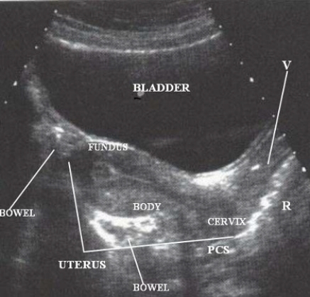 Using the image below, describe the anatomic relationship of the vagina to adjacent structures.