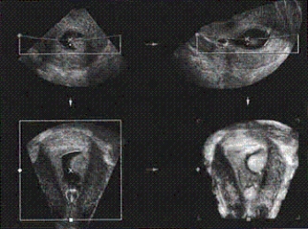 In this figure, the image shown in surface mode is in the __________ corner.