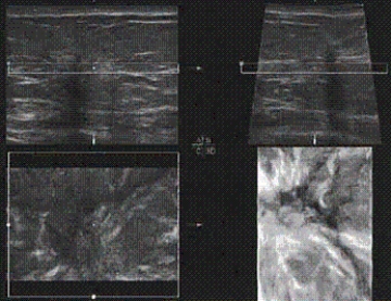 The main anatomy shown on this image is a(n) __________.
