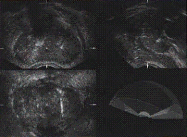 The main anatomy shown on this image is the __________.