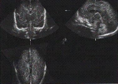 The main anatomy shown on this image is the __________.