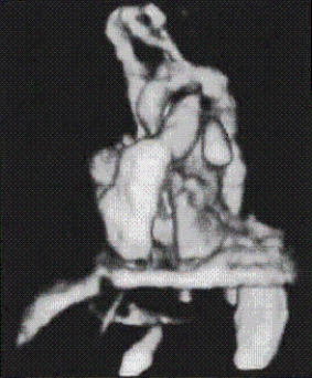 The main anatomy shown on this image is the __________.